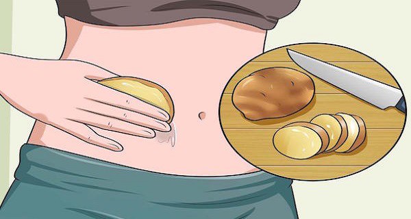 Pomme de terre ses bienfaits