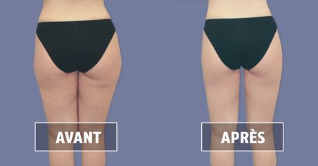 culotte de cheval