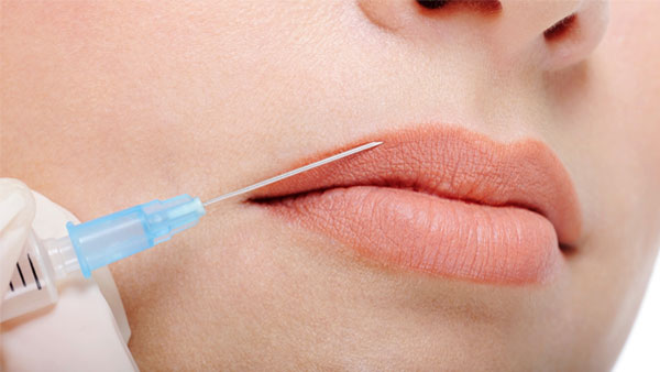 Chirurgie des levres