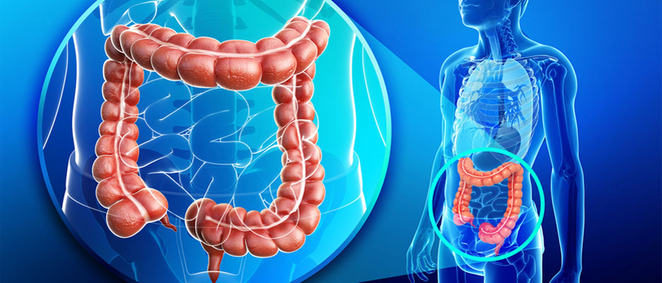 Illustration d’une personne ressentant des troubles digestifs et du côlon, comme constipation, diarrhée alternante et douleurs abdominales persistantes