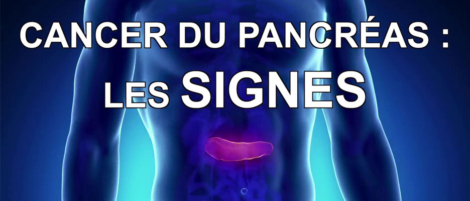 cancer digestif ou du pancréas