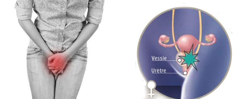 Troubles du transit et urinaires : signes d’alerte digestifs et urinaires à ne pas ignorer