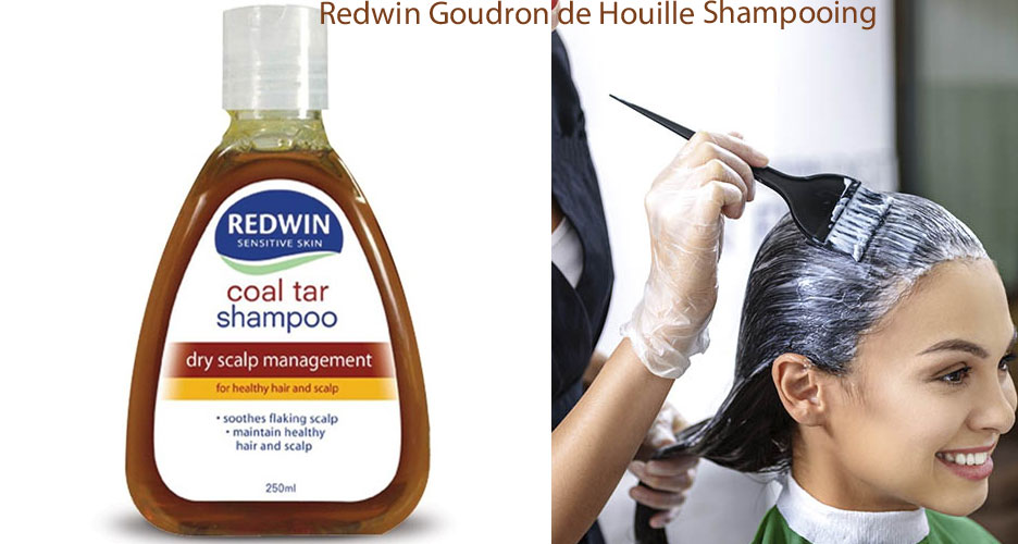 Le goudron de houille
